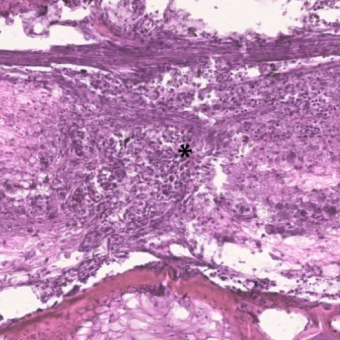 Medul·les espinals de peix zebra sense signes de fibrosi (és a dir, sense tinció blava) en el lloc de la lesió (asterisc).