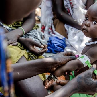 Mesurament del nivell de malnutrició en un infant d'un camp de refugiats a Etiòpia.