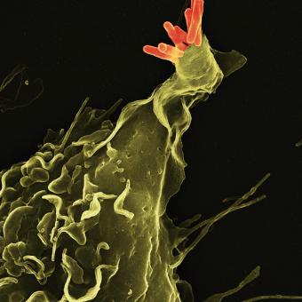 Micrografia electrònica de rastreig (MER) en color d’un macròfag fagocitant el bacteri de la vacuna de la tuberculosi.
