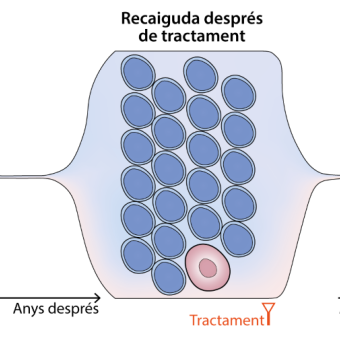Esquema de l'evolució de la leucèmia cap a un tumor més agressiu. Les cèl·lules de cada color (verd, blau i rosa) representen una subpoblació del tumor. L'estudi identifica com les cèl·lules que donen lloc a la recaiguda després del tractament (blaves) i a la transformació cap a un tumor més agressiu (roses) ja estaven presents, en petita quantitat, en el moment del diagnòstic.