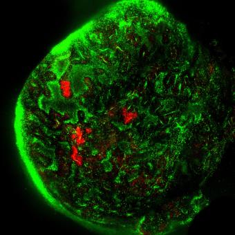 PADME Fotoconversión de verde a rojo de las áreas de interés en un tumor de ratón.