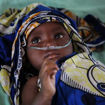 17 month old baby hospitalized in Mali. © Seyba Keita_ALIMA.