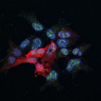 Células en las que se estudia una proteína (en verde) implicada en la metástasis del cáncer de mama. © Alícia Llorente. IRB Barcelona.