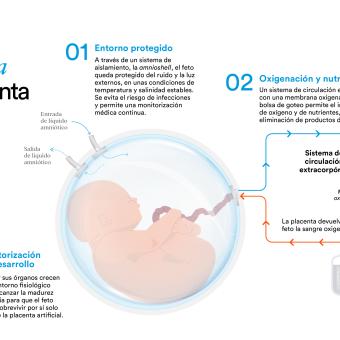 Infografía que ilustra el funcionamiento del prototipo de placenta artificial del proyecto CaixaResearch Placenta Artificial.