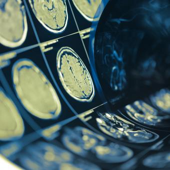 Pruebas en el cerebro humano.