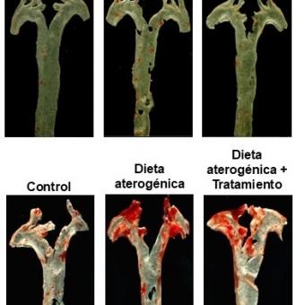 A dalt: artèria aorta amb tinció en vermell de la placa ateroscleròtica de ratolins tractats amb el metabòlit bacterià propionat d'imidazol (ImP) i amb el fàrmac inhibidor del seu efecte proaterogènic (tractament). A baix: artèria aorta amb tinció en vermell de la placa ateroscleròtica de ratolins tractats amb dieta alta en colesterol que indueix aterosclerosi durant 8 setmanes i tractats durant les quatre darreres setmanes del tractament amb el fàrmac bloquejant de l'efecte inductor del propionat d'imidazol.