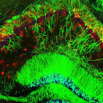 Visualización de los circuitos cerebrales implicados en la depresión: un enfoque en el hipocampo donde las neuronas (que expresan la proteína fluorescente verde, EGFP) forman circuitos definidos que se entremezclan con los astrocitos (que expresan la proteína fluorescente roja, mCherry).