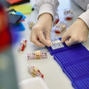 La convocatoria premia proyectos de investigación básica, clínica y traslacional. 