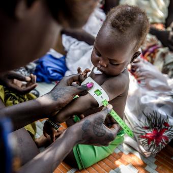 Mesurament del nivell de malnutrició d'un nen a un camp de refugiats d'Etiòpia.
