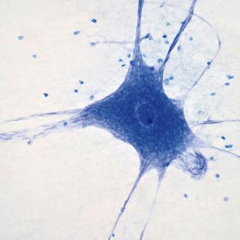 Microscòpia de neurones cerebrals.