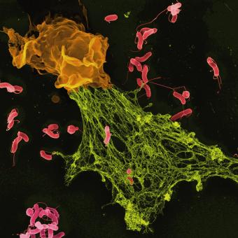 Micrografia electrònica de rastreig (MER) en color de bacteris Helicobacter atrapats en una trampa extracel·lular de neutròfils.