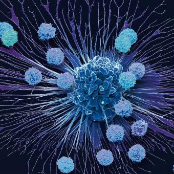 Micrografia electrònica de rastreig (MER) en color d’unes cèl·lules T i una cèl·lula de càncer de coll uterí apoptòtica (HeLa).