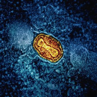 Microscòpia del virus de la verola.