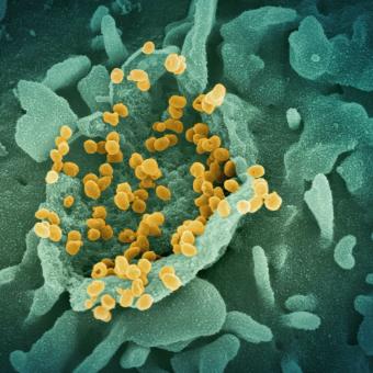 Micrografia electrònica de rastreig (MER) en color en què es mostra el virus SARS-CoV-2 (partícules rodones grogues) emergint a la superfície d’una cèl·lula cultivada al laboratori.