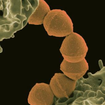 Micrografia electrònica de rastreig (MER) en color de «Streptococcus pyogenes» i un neutròfil humà.
