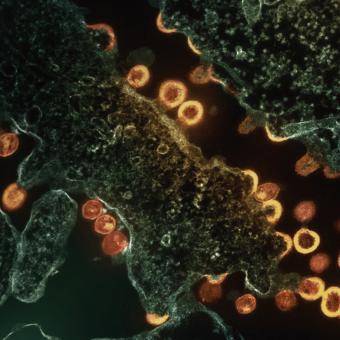 Micrografia electrònica de transmissió de partícules del VIH-1 gemmant i replicant-se a partir d’un segment d’una cèl·lula  T H9 amb infecció crònica.