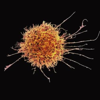 Micrografia electrònica de rastreig (MER) en color d’una cèl·lula NK.