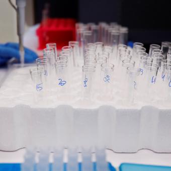 Imatge d'arxiu de material de laboratori. 