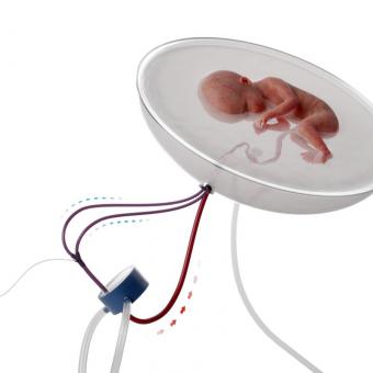 Recreación de cómo podría ser la futura aplicación clínica del proyecto en humanos.