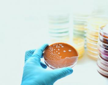 Superbacteris: Com podem afrontar una de les amenaces més grans per a la salut global?