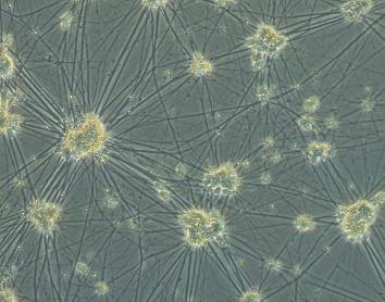 Motoneuronas maduras in vitro. 