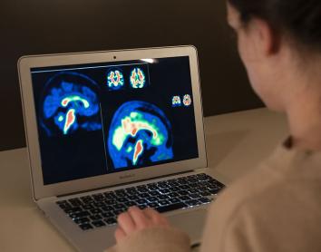 Investigadores europeos mejoran la sensibilidad del diagnóstico de las fases iniciales del Alzheimer
