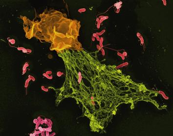 Micrografía electrónica de barrido (MEB) en color de bacterias «Helicobacter» atrapadas en una trampa extracelular de neutrófilos.