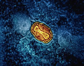 Microscopía del virus de la viruela.