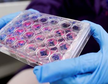 Enfermedad hepática crónica en Europa: una crisis prevenible que pasa desapercibida