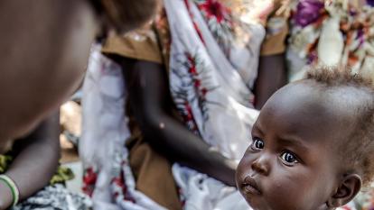 Measuring the level of malnutrition of a child in a refugee camp in Ethiopia.