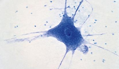 Microscòpia de neurones cerebrals.
