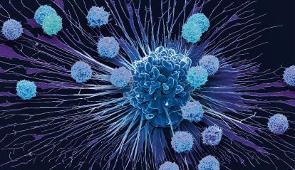 Micrografia electrònica de rastreig (MER) en color d’unes cèl·lules T i una cèl·lula de càncer de coll uterí apoptòtica (HeLa).