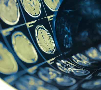 Pruebas en el cerebro humano.