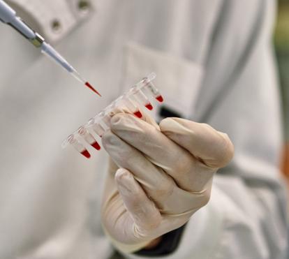 Un investigador manipula material de laboratorio. 