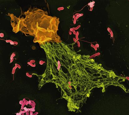 Micrografia electrònica de rastreig (MER) en color de bacteris Helicobacter atrapats en una trampa extracel·lular de neutròfils.