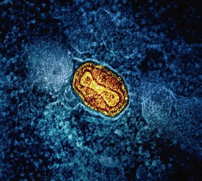 Microscòpia del virus de la verola.