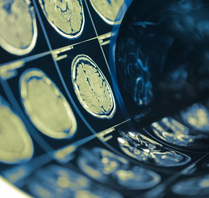 Pruebas en el cerebro humano.