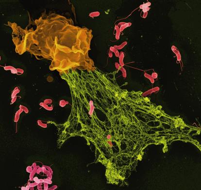  Coloured scanning electron micrograph (SEM) of Helicobacter bacteria caught in a neutrophil extracellular trap.