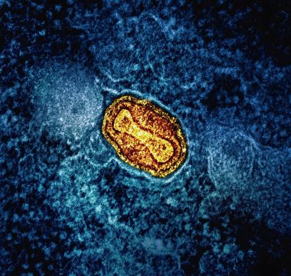  Microscopy of the smallpox virus.