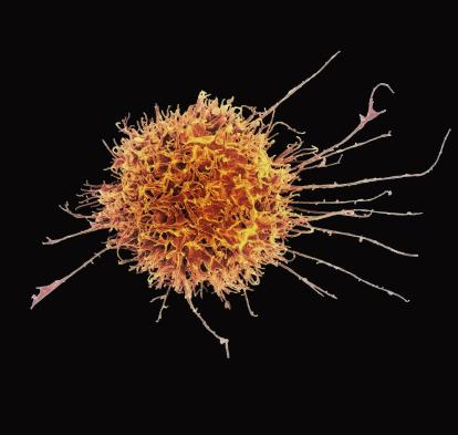 Coloured scanning electron micrograph (SEM) of an NK cell.