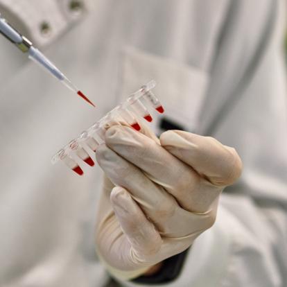 34 biomedical research projects with potential social impact receive 26 million in funding from the ”la Caixa” Foundation