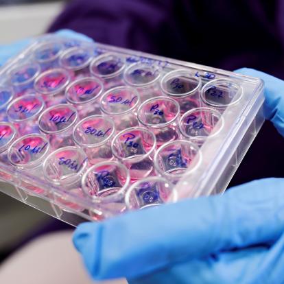 Malaltia hepàtica crònica a Europa: una crisi prevenible que passa desapercebuda