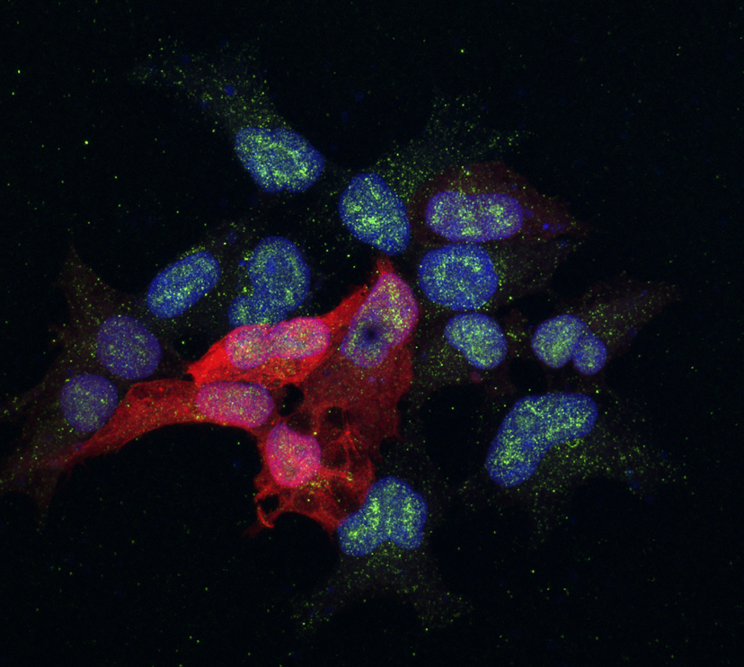 Células en las que se estudia una proteína (en verde) implicada en la metástasis del cáncer de mama. © Alícia Llorente. IRB Barcelona.