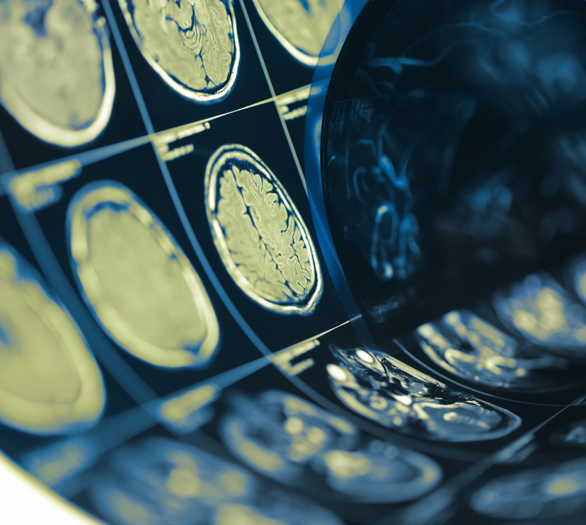 Pruebas en el cerebro humano.