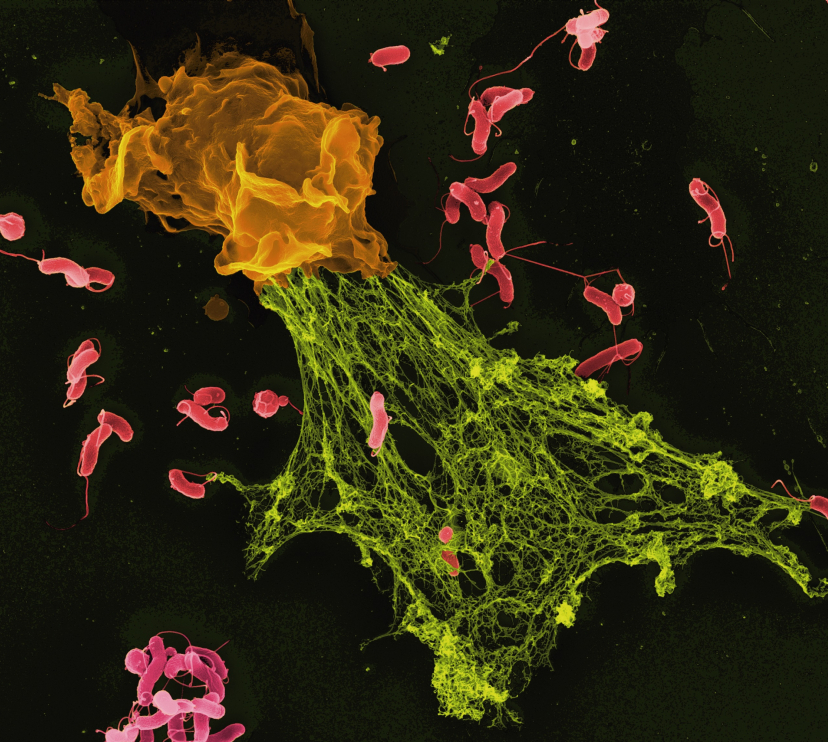 Micrografia electrònica de rastreig (MER) en color de bacteris Helicobacter atrapats en una trampa extracel·lular de neutròfils.