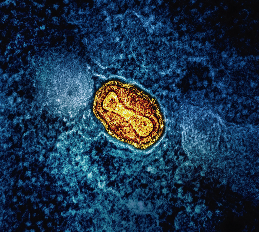 Microscòpia del virus de la verola.